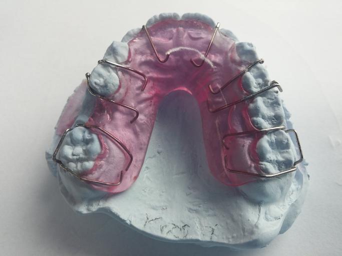 rovnání zubů – drátky na modelu